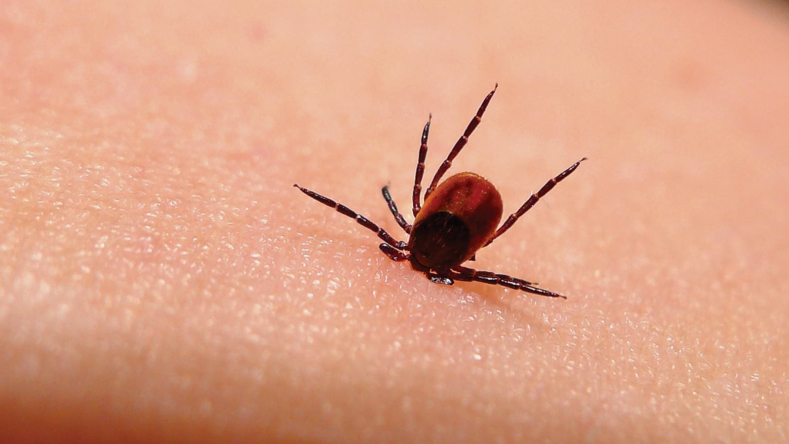 MAC12_LYMEDISEASE_CAROUSEL01