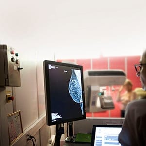 Radiology service in a hospital in Haute-Savoie, France. Digital mammogram. (BSIP/UIG/Getty Images)