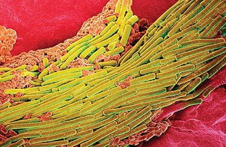 Gut of the matter