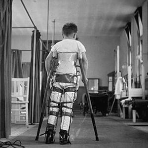 A child suffering from Infantile Paralysis learning to walk with the aid of a special support, at Queen Mary's Hospital, London, 1947. (George Konig/Keystone Features/Getty Images)