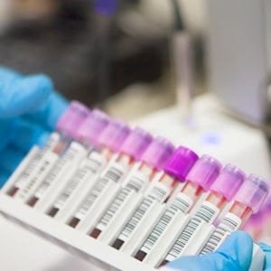 Laboratory Experiment blood test
