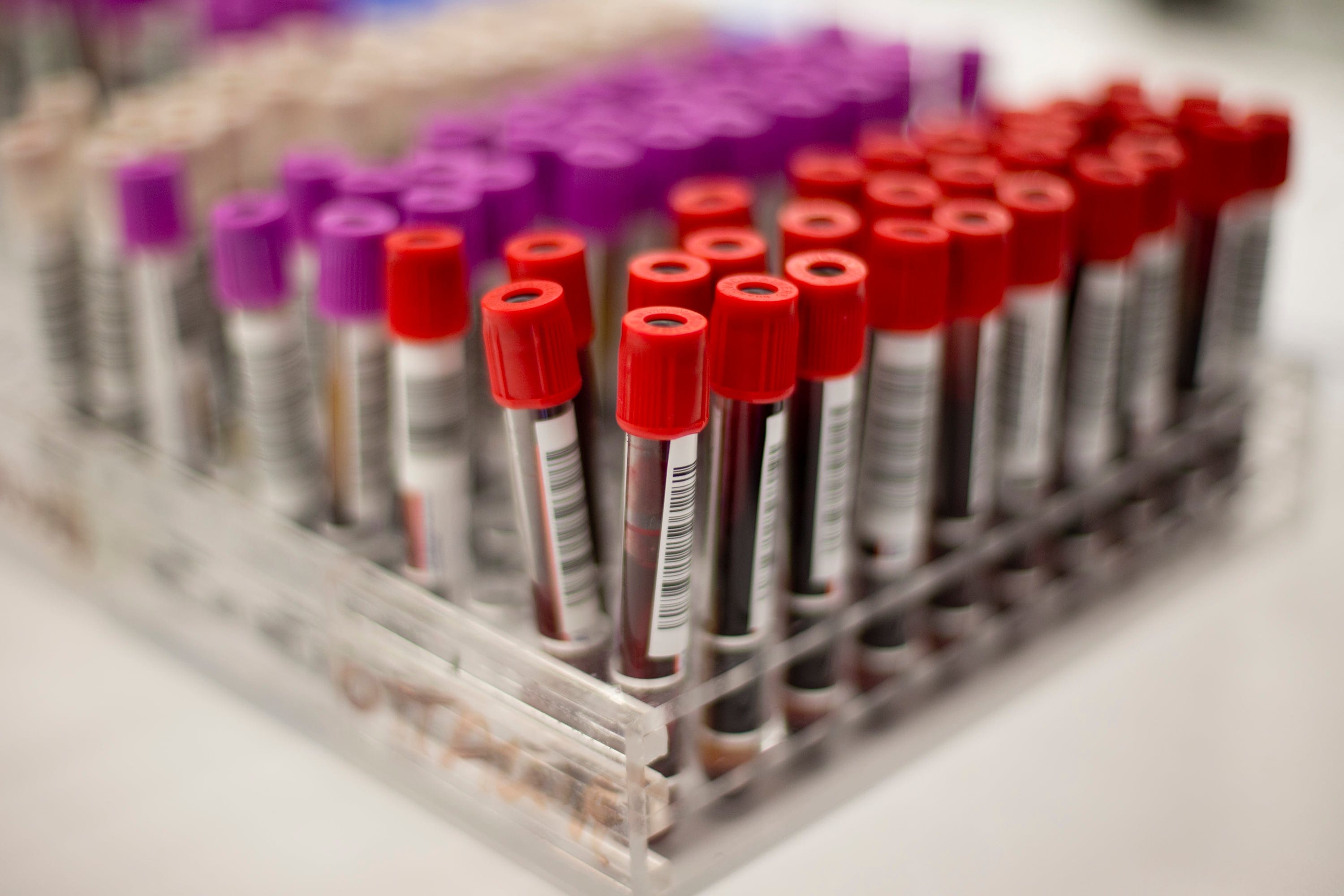 TORONTO, ON - MAY 26: Canadian Blood Services donation clinic on College Street. For Insight feature on strategies that have reduced demand on the Canadian blood supply and new theories on the dangers of ordinary transfusions. (Keith Beaty/Toronto Star via Getty Images)