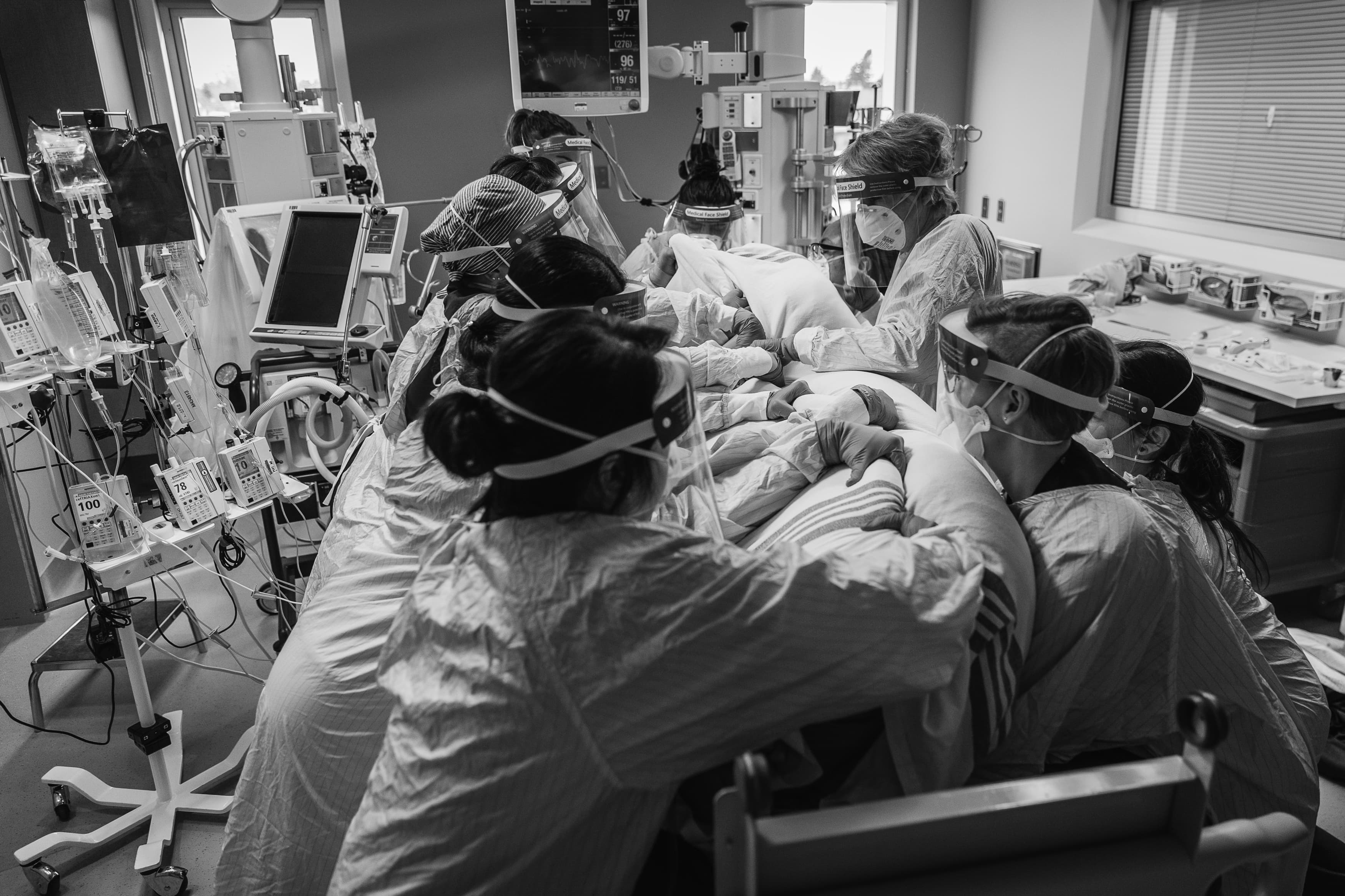 10 individuals required to prone an ICU patient. (Heather Patterson Photography)