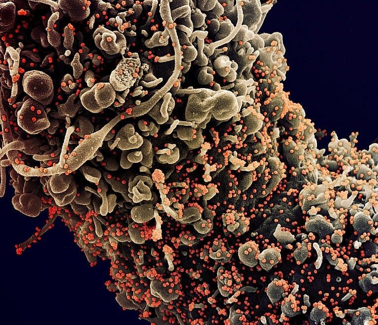 This colourized image, taken with a scanning electron microscope, shows a dying cell in a COVID-infected patient; the SARS-CoV-2 virus particles are in orange (Courtesy of NIAID)